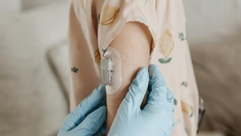 A healthcare professional adjusts a glucose monitor on a child's arm, highlighting diabetes care