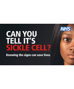 Sickle Cell image