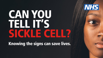 A woman looking forward, text reads "Can you tell it's sickle cell? Knowing the signs can save lives."